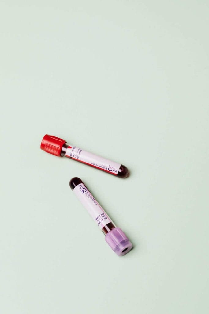 Complete blood count in children and adults