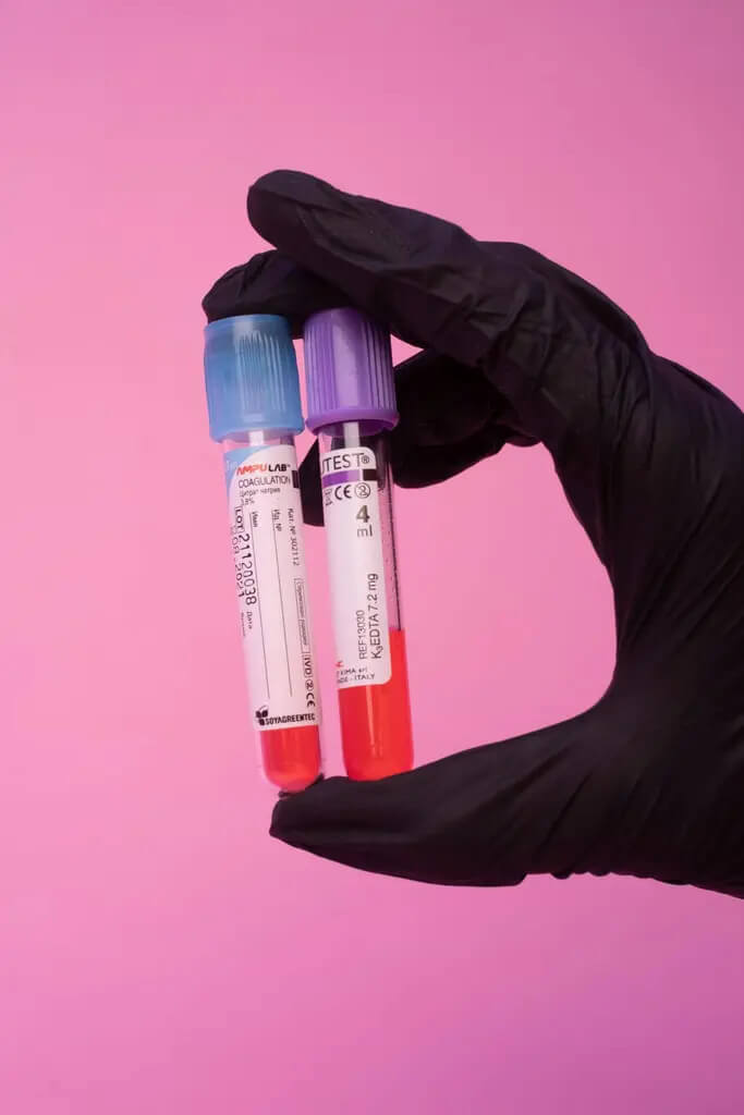 Should healthy children get regular blood tests?